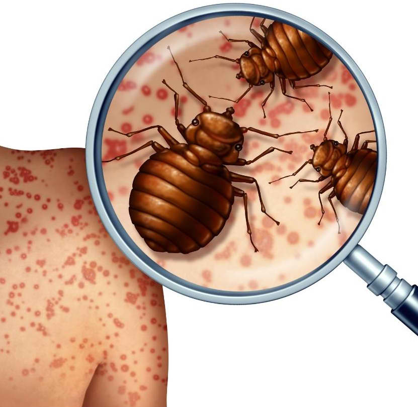 Bed Bugs Treatment